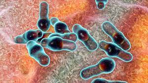 BOTULISMO EN MISIONES: CUATRO PERSONAS INTERNADAS